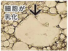 皮下脂肪にアタック【超音波（キャビテーション現象）で皮下脂肪を分解】
