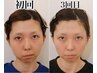 新★【顔の左右差矯正コース】～顔の土台から骨格を整える美容施術～