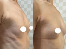 50代のお客様もこんなにハリのあるバストに♪貴女も挑戦してみて