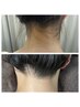 初回限定★THR.IPL光/うなじorワキ脱毛 ／女性脱毛／男性脱毛¥4800→¥2.200