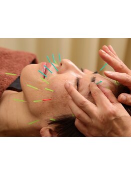 鍼灸施術を受けたい