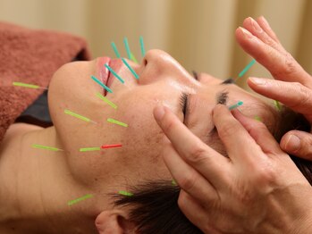 井原鍼灸整骨院の写真/"大人気の美容鍼"でお悩み改善!ほうれい線/むくみ/目元/お顔のタルミ/小ジワ/小顔になりたい方にオススメ☆