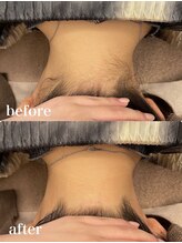 ディオーネ 自由が丘(Dione)/襟足脱毛【20代 &nbsp;施術1回】