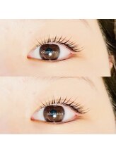 オルマノ(OLUMANO)/【メーテルデザインリフト】