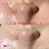 ピュアボーテ(PURE BEAUTE)