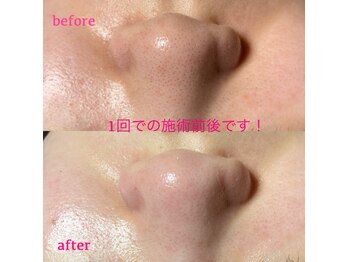 ピュアボーテ(PURE BEAUTE)