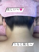 ミヤビ 竹ノ塚店(MIYA美)/後ろ姿美人は、うなじから♪