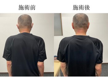 ブロッサム(Blossom)/姿勢改善・首、肩こり改善