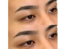 バルブ(BaREB)