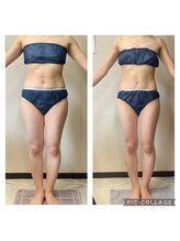 美ボディラボ(美Body Labo)/最新マシンでセル脂肪撃退♪
