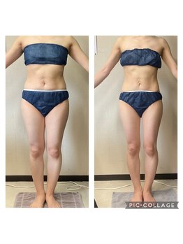 美ボディラボ(美Body Labo)/最新マシンでセル脂肪撃退♪