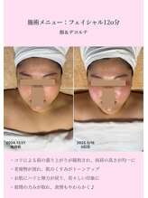 プラスワンビューティテン 新大阪店(Plus One Beauty)/フェイシャル