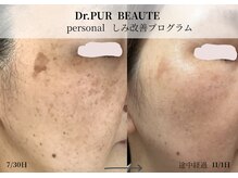 カンパニュラ(campanula)