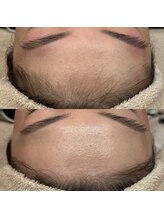 イロドリ(IRODORI)/フェイシャルWaxでつや肌に！