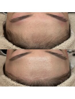 イロドリ(IRODORI)/フェイシャルWaxでつや肌に！