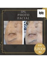 ココ(COCO)/光フェイシャル