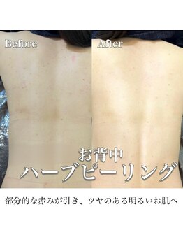 エムラボ 銀座店(M LABO)/ビフォーアフター