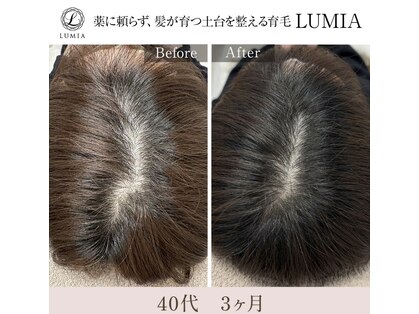 ルミア(LUMIA)の写真