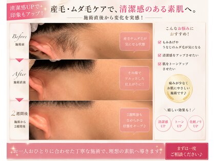 シェリール(CHIRIEUR)の写真