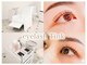 ティンク(Tink)の写真
