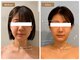 アセンド(ASCEND)の写真/筋肉、骨格矯正だけでなく、リンパケアまで叶う次世代コルギ(コルグン)で小顔が続く&透明感も◎
