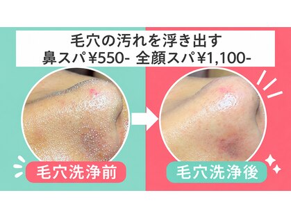 ビービー(BB)の写真