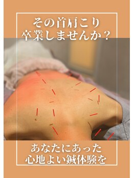 リエナ 馬車道院(Liena.)の写真/【男性歓迎/馬車道1分】仕事の疲労リセット！メンズ美容鍼＆首肩こり解消鍼灸で清潔感&すっきり軽い体に◎