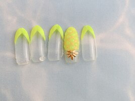 夏と言えば！パイナップルネイル