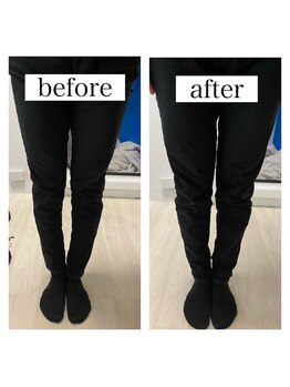 エリシオン(ELYSION)/美脚整体