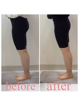 スタイルラボ高松/産後骨盤矯正の効果♪