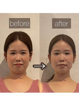 東京デトックス/ファスティング7日間プログラム