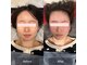 プライミー(PRIMY)の写真