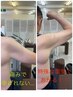 日常生活での急な痛みを早期改善
