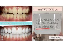 ラフィト(Ra huit)の雰囲気（【歯科医師監修セルフホワイトニング】4来店/12照射）