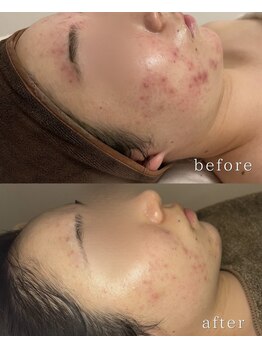 リルビー(Lilby)の写真/お肌悩みには、肌育×肌質改善を。