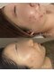 リルビー(Lilby)の写真/お肌悩みには、肌育×肌質改善を。