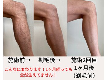 バニッシュ 川口店(VANISH)/効果実感が早い！