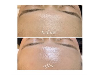 トゥルーカインド(true kind)/フェイシャルワックス