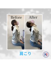 まこと整体院 新鳥栖店/ビフォーアフター（首、肩こり）