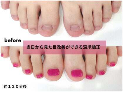 インブロッサム(imblossom)の写真