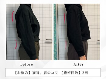 レッド(RED)/慢性的な体の痛みも改善