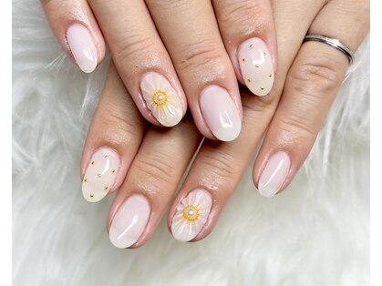 マイオティック ネイル(miotic nail)の写真