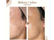 サンタ(SANTA.)の雰囲気(ララピールのビフォー・アフター)