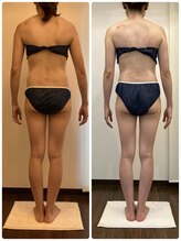 プリンセス ボディ/3ヵ月5回目/ビフォーアフター