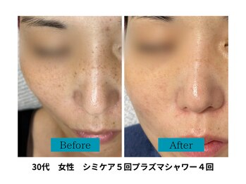 ビジュツ(BIJYUTSU)/