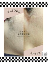 ビー ファクトリー(B FACTORY)/もみあげ