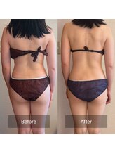 salon SUI 祐天寺【スウェディッシュマッサージ/美容整体/首肩こり頭痛】/美容整体