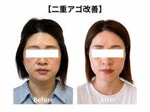 クローバー(clover)の雰囲気（小顔ケアでフェイスラインを引き締め理想の輪郭へ導きます）