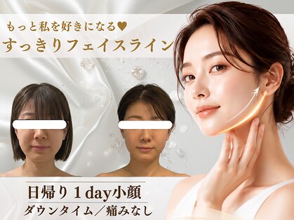 シュエマ(CHOUEMA)の写真