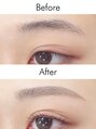 アイム 自由が丘店(i’m) 【Before→After】